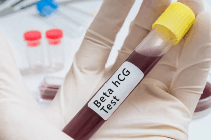 valori beta hCG nella seconda settimana di concepimento