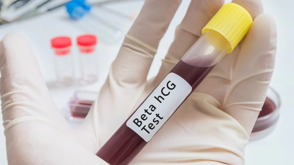 valori beta hCG nella seconda settimana di concepimento